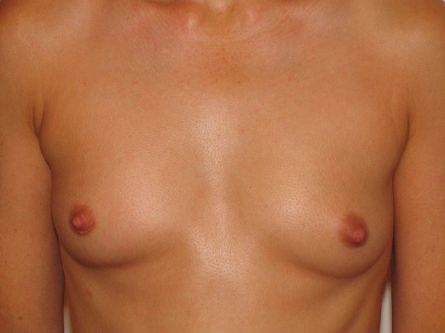 Rate Me