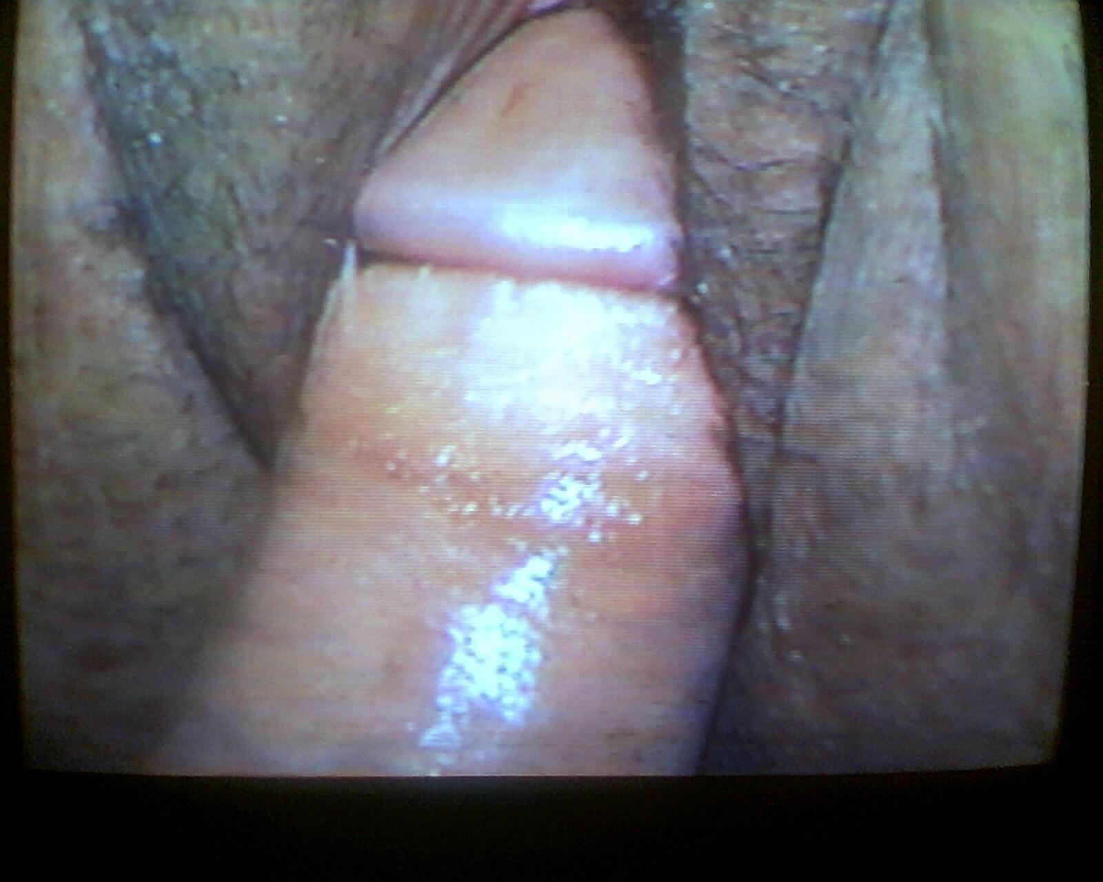 Rate Me